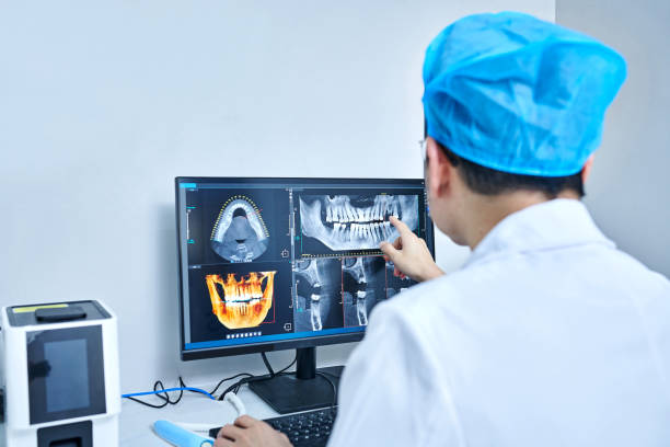 Best Emergency Tooth Extraction in Cherryville, PA